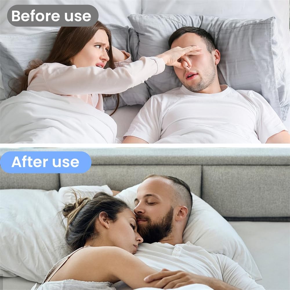 Anti-snoring Tongue Retainer For Mouth Snorers